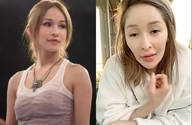 Sốc nặng với "gương mặt rắn" biến dạng của nữ ca sĩ hạng A sau vụ bị chó cắn đến hủy dung- Ảnh 4.