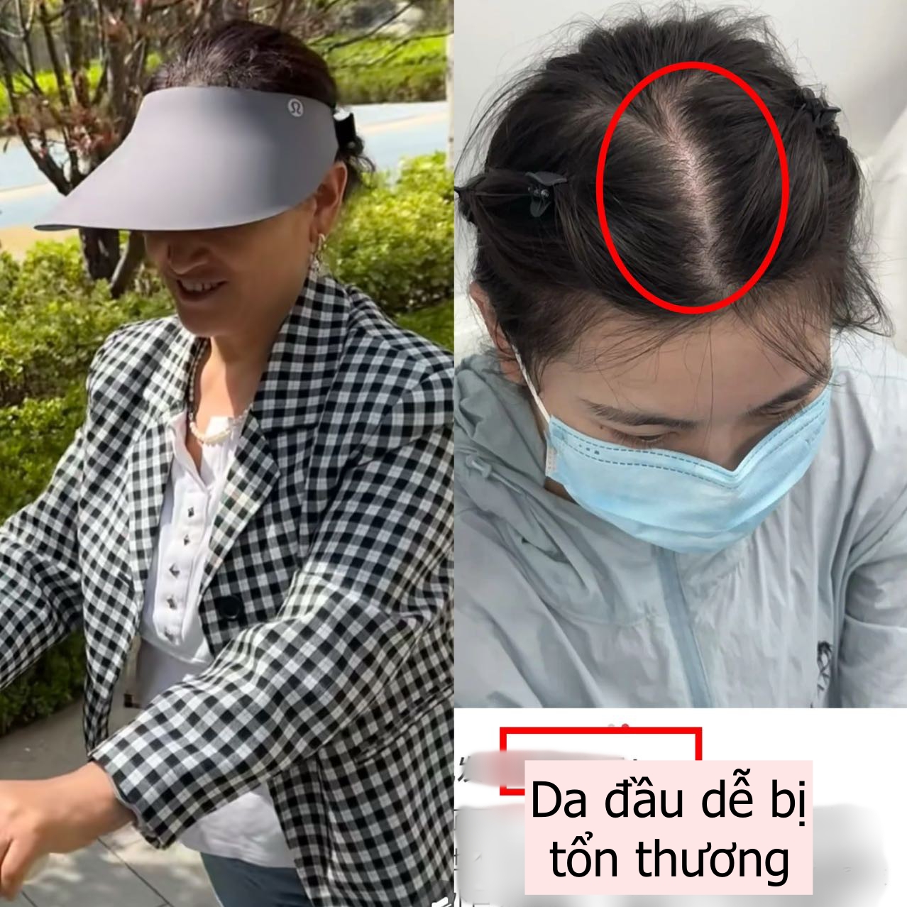 Lời khuyên cho phụ nữ trung niên: 3 kiểu mũ "dù có cho cũng đừng đội" vì vừa rẻ tiền vừa không chống nắng!- Ảnh 4. Lời khuyên cho phụ nữ trung niên: 3 kiểu mũ "dù có cho cũng đừng đội" vì vừa rẻ tiền vừa không chống nắng!- Ảnh 4.
