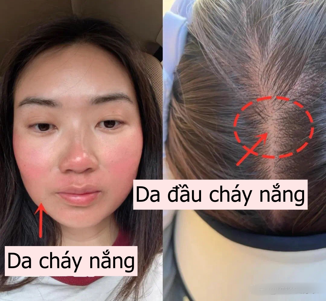 Lời khuyên cho phụ nữ trung niên: 3 kiểu mũ "dù có cho cũng đừng đội" vì vừa rẻ tiền vừa không chống nắng!- Ảnh 8. Lời khuyên cho phụ nữ trung niên: 3 kiểu mũ "dù có cho cũng đừng đội" vì vừa rẻ tiền vừa không chống nắng!- Ảnh 8.