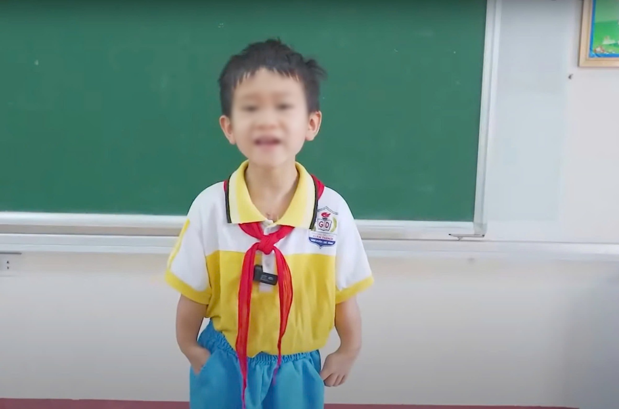 Hành trình tìm lại đôi tay lành lặn cho cậu bé mê hát dân ca- Ảnh 2.