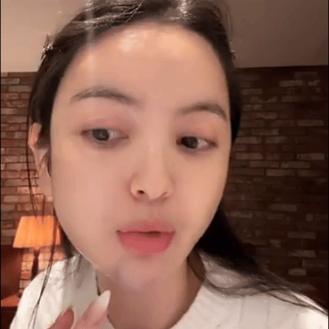 Chu Thanh Huyền lộ cằm bầm tím trên livestream, netizen tiếc thay nhan sắc thời chưa "dao kéo"- Ảnh 1.