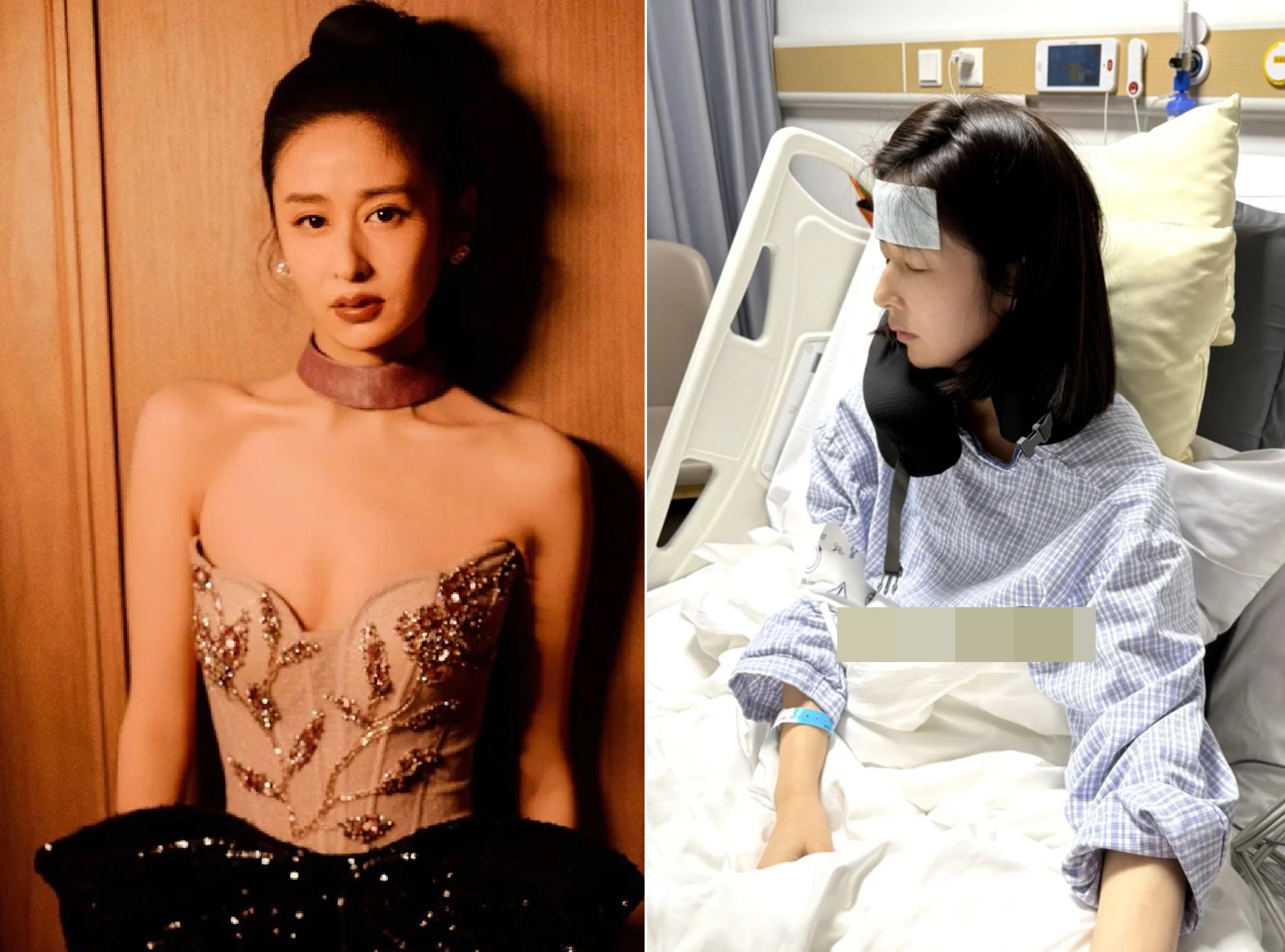 Một nữ diễn viên hạng A phải cắt bỏ túi mật vì sỏi mật, túi mật mất chức năng- Ảnh 1. Một nữ diễn viên hạng A phải cắt bỏ túi mật vì sỏi mật, túi mật mất chức năng- Ảnh 1.