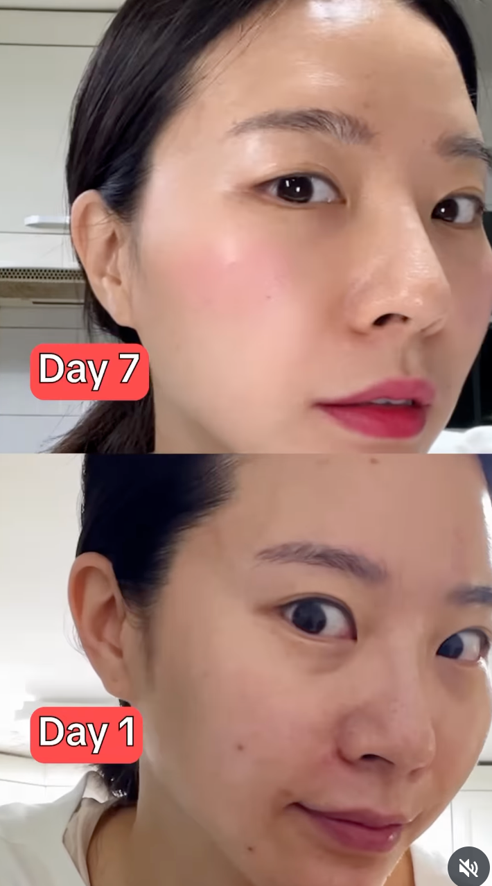 Phụ nữ Hàn Quốc uống 1 cốc nước này mỗi ngày để giúp mờ nám, da hết mụn và sáng mịn thấy rõ- Ảnh 9.