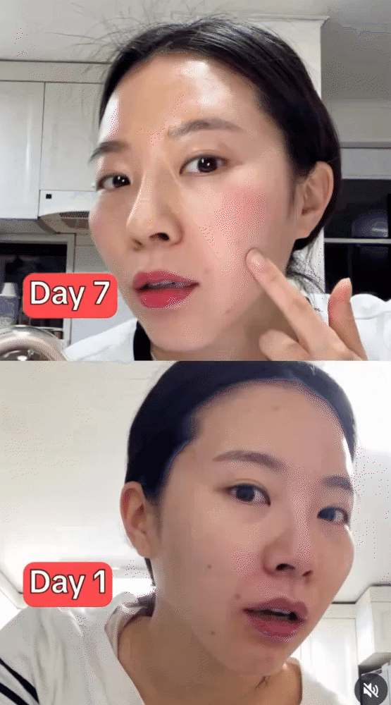 Phụ nữ Hàn Quốc uống 1 cốc nước này mỗi ngày để giúp mờ nám, da hết mụn và sáng mịn thấy rõ- Ảnh 8.