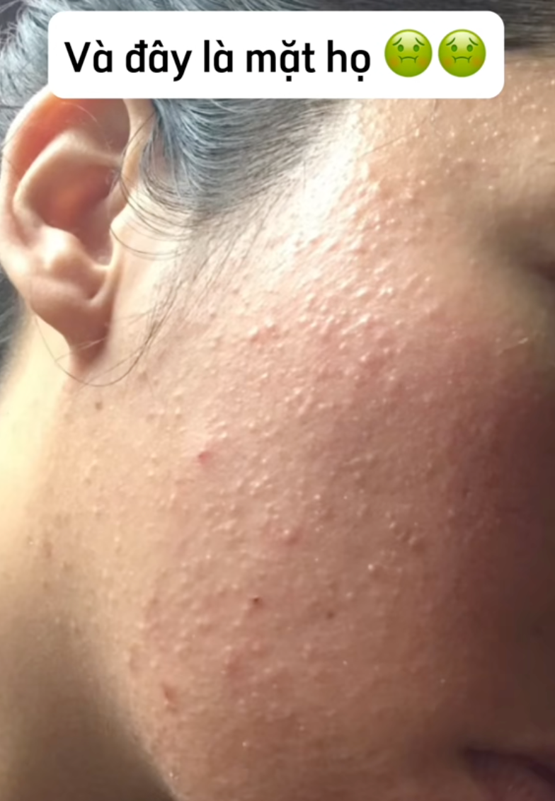 Một thói quen khi đi ngủ có thể hủy hoại mái tóc và làn da mà các chị em không hề hay biết- Ảnh 2.