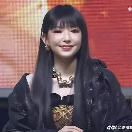 Ngoại hình phù nề gây sốc của nữ idol đẹp nhất showbiz, dao kéo đến như này hết đường chối!- Ảnh 3.