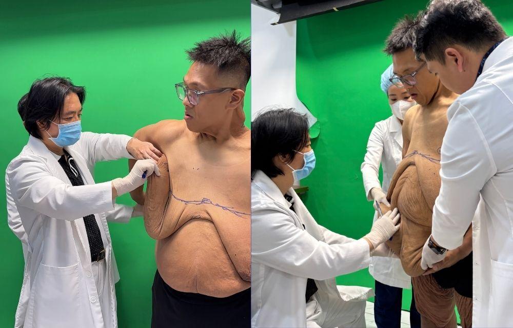 Trọng Nhân Bye Béo chốt lịch cắt da, hứa hẹn làm nên dấu mốc thẩm mỹ tại Việt Nam- Ảnh 3.