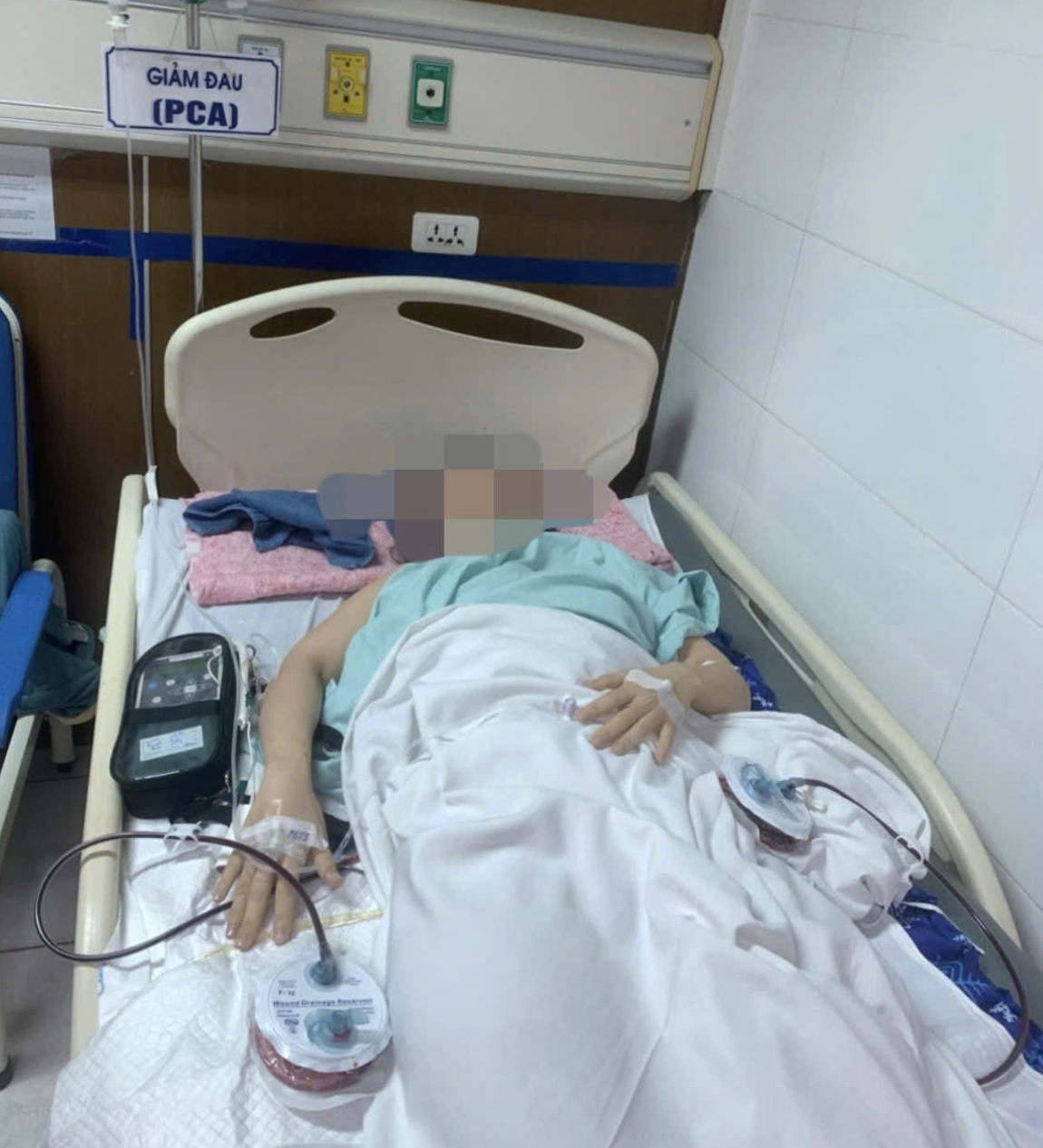 Vụ sập khung đèn tiệc cưới khiến cô gái thương tật 96%: Nạn nhân có quyền yêu cầu bồi thường bao nhiêu tiền?- Ảnh 1.