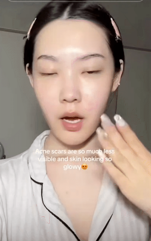Hũ vitamin C "lạ đời" được beauty blogger thi nhau review: Da căng mướt, vết thâm mờ hẳn sau vài ngày- Ảnh 3. Hũ vitamin C "lạ đời" được beauty blogger thi nhau review: Da căng mướt, vết thâm mờ hẳn sau vài ngày- Ảnh 3.
