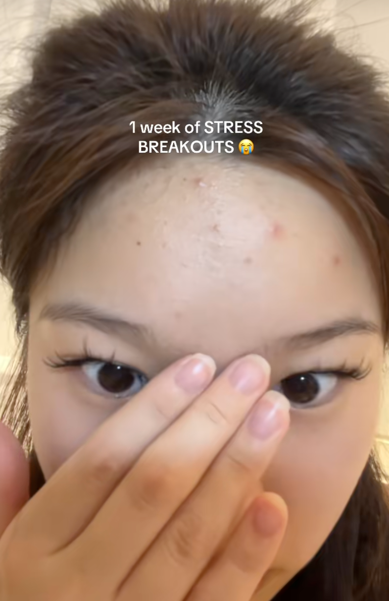 Hũ vitamin C "lạ đời" được beauty blogger thi nhau review: Da căng mướt, vết thâm mờ hẳn sau vài ngày- Ảnh 13. Hũ vitamin C "lạ đời" được beauty blogger thi nhau review: Da căng mướt, vết thâm mờ hẳn sau vài ngày- Ảnh 13.