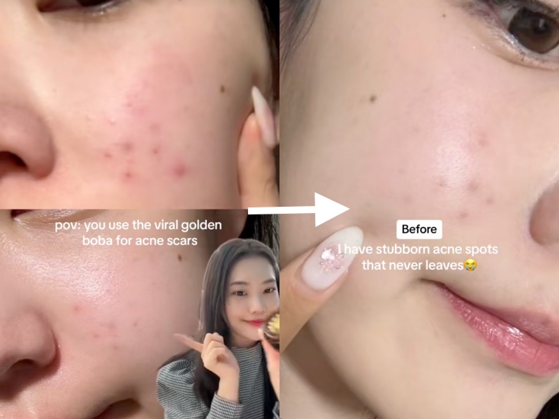 Hũ vitamin C "lạ đời" được beauty blogger thi nhau review: Da căng mướt, vết thâm mờ hẳn sau vài ngày- Ảnh 1. Hũ vitamin C "lạ đời" được beauty blogger thi nhau review: Da căng mướt, vết thâm mờ hẳn sau vài ngày- Ảnh 1.
