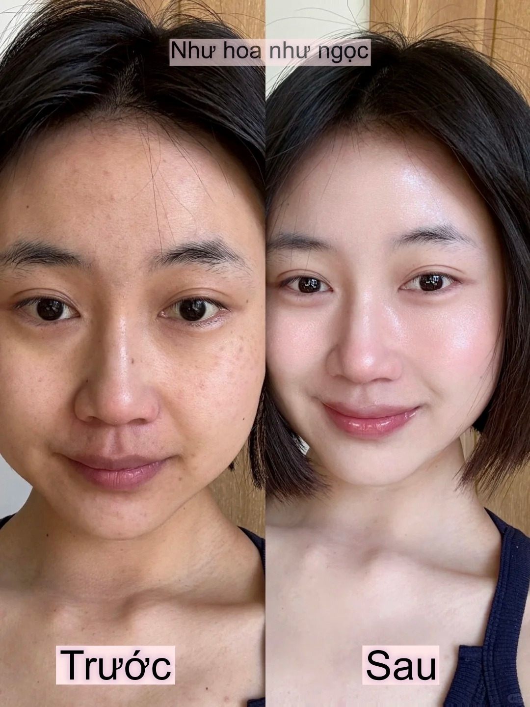 Bổ sung collagen suốt 1 năm và đây là điều đã thay đổi trên gương mặt tôi- Ảnh 3.
