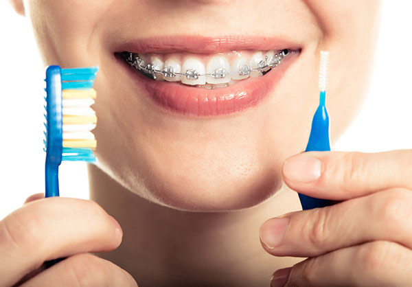 Những sai lầm trong chăm sóc răng miệng khi đang niềng: Cẩn trọng kẻo "mất cả hàm răng"- Ảnh 2.