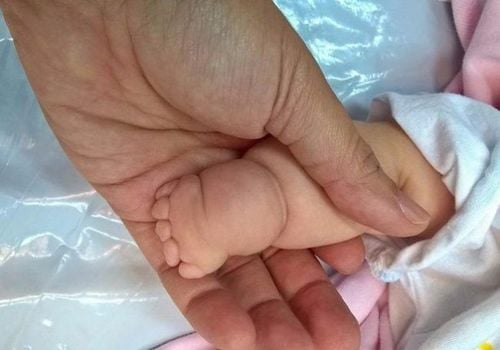 Thai nhi 21 tuần bị cắt cụt các ngón tay vì một thứ "sắc hơn dao" ngay trong bụng mẹ: Nguy hiểm nhưng khó phát- Ảnh 4.