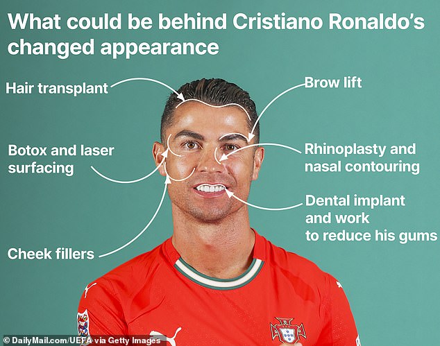 Ronaldo 40 tuổi vẫn đẹp trai cực phẩm, bác sĩ thẩm mỹ khui loạt bí mật "dao kéo" tốn kém bạc tỷ- Ảnh 6.