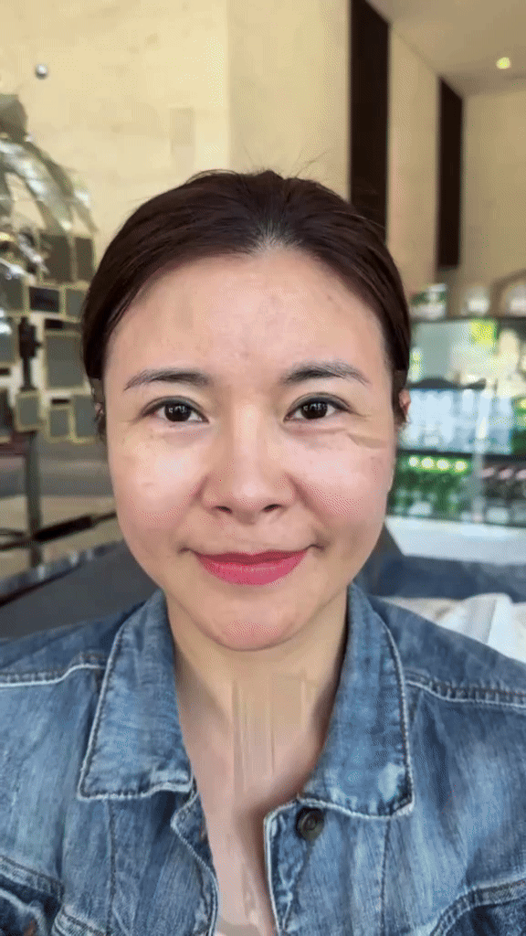 Diễn viên Vbiz "đập mặt xây lại" ở Hàn: Mặt băng bó chằng chịt, 2 đêm đầu khó chịu không thể thở- Ảnh 2.