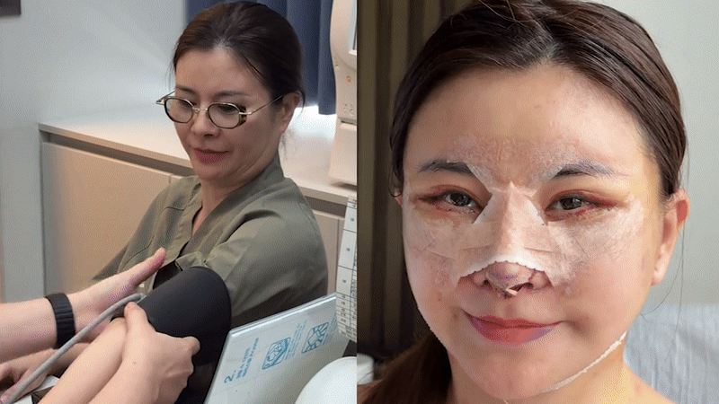Diễn viên Vbiz "đập mặt xây lại" ở Hàn: Mặt băng bó chằng chịt, 2 đêm đầu khó chịu không thể thở- Ảnh 1.
