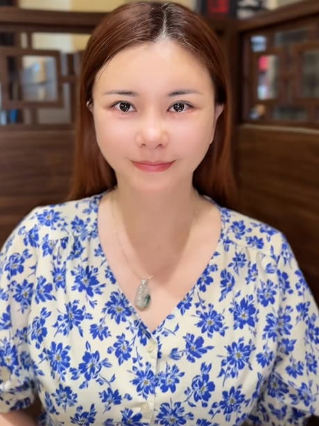 Diễn viên Vbiz "đập mặt xây lại" ở Hàn: Mặt băng bó chằng chịt, 2 đêm đầu khó chịu không thể thở- Ảnh 7.