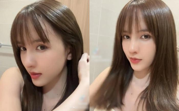 Thiều Bảo Trâm bị biến chứng hậu "dao kéo"?- Ảnh 4.