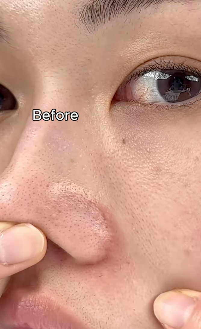 Lọ serum retinol 0.2% khiến beauty blogger Hàn bất ngờ về khả năng "trẻ hóa" da sau 7 ngày- Ảnh 2.