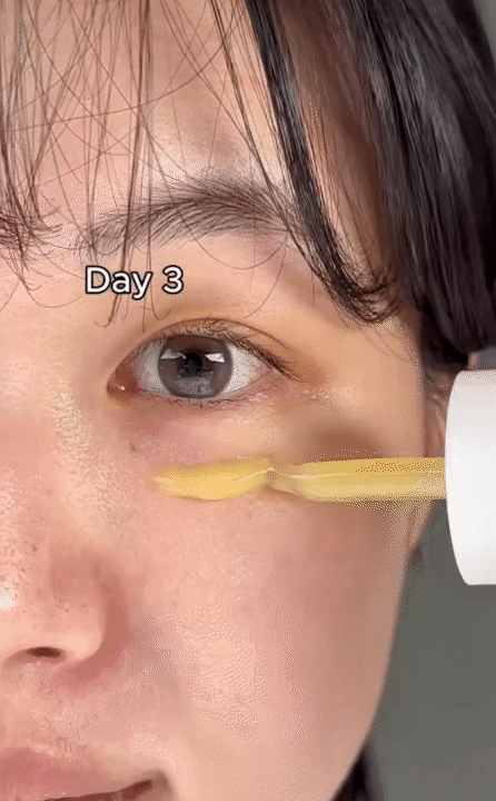 Lọ serum retinol 0.2% khiến beauty blogger Hàn bất ngờ về khả năng "trẻ hóa" da sau 7 ngày- Ảnh 4.
