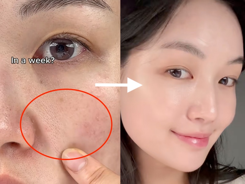 Lọ serum retinol 0.2% khiến beauty blogger Hàn bất ngờ về khả năng "trẻ hóa" da sau 7 ngày- Ảnh 7.