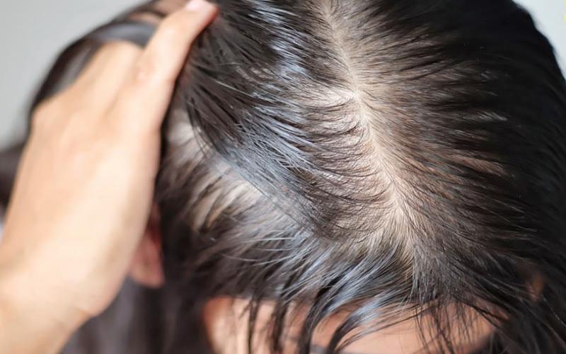 Tôi đã dùng thứ nước nhờn nhụa từ đậu bắp để ngăn tóc rụng "như lá mùa thu", 3 tháng sau điều bất ngờ đến- Ảnh 1.