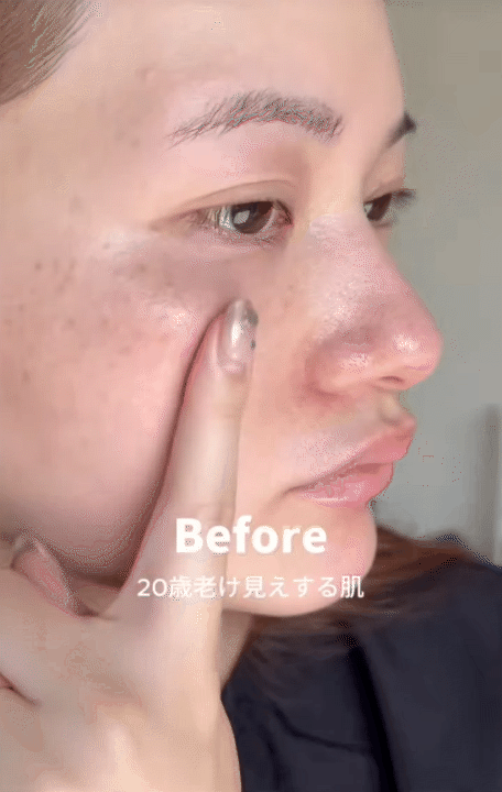 Cách trị nám của phụ nữ Nhật: Chỉ thêm một bước đơn giản mà sau 1 tuần da sáng bật tông- Ảnh 10.