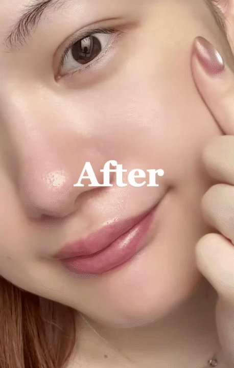 Cách trị nám của phụ nữ Nhật: Chỉ thêm một bước đơn giản mà sau 1 tuần da sáng bật tông- Ảnh 5.