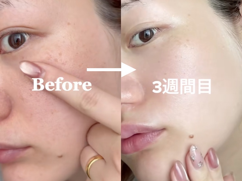 Cách trị nám của phụ nữ Nhật: Chỉ thêm một bước đơn giản mà sau 1 tuần da sáng bật tông- Ảnh 3.