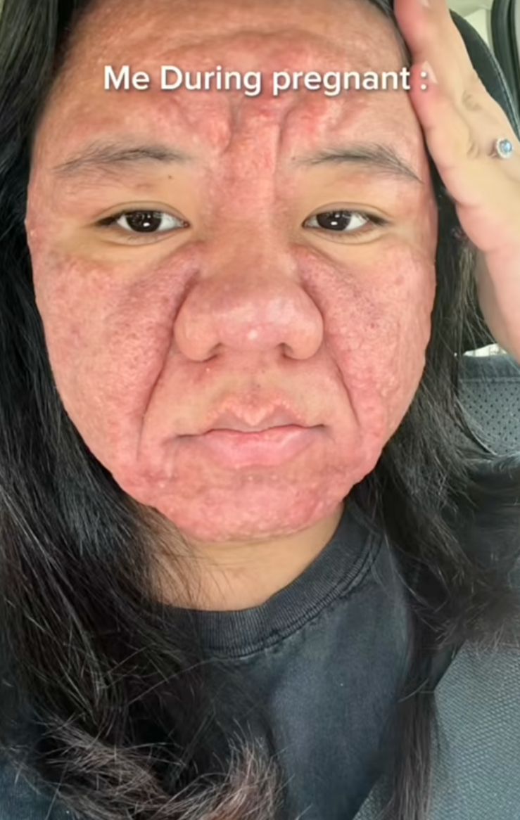 Mẹ bỉm 28 tuổi chia sẻ hình ảnh mang thai với gương mặt biến đổi hoàn toàn khiến cả cõi mạng dậy sóng- Ảnh 3.