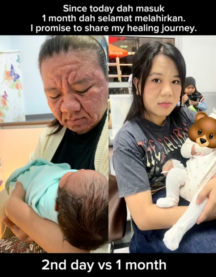 Mẹ bỉm 28 tuổi chia sẻ hình ảnh mang thai với gương mặt biến đổi hoàn toàn khiến cả cõi mạng dậy sóng- Ảnh 7.