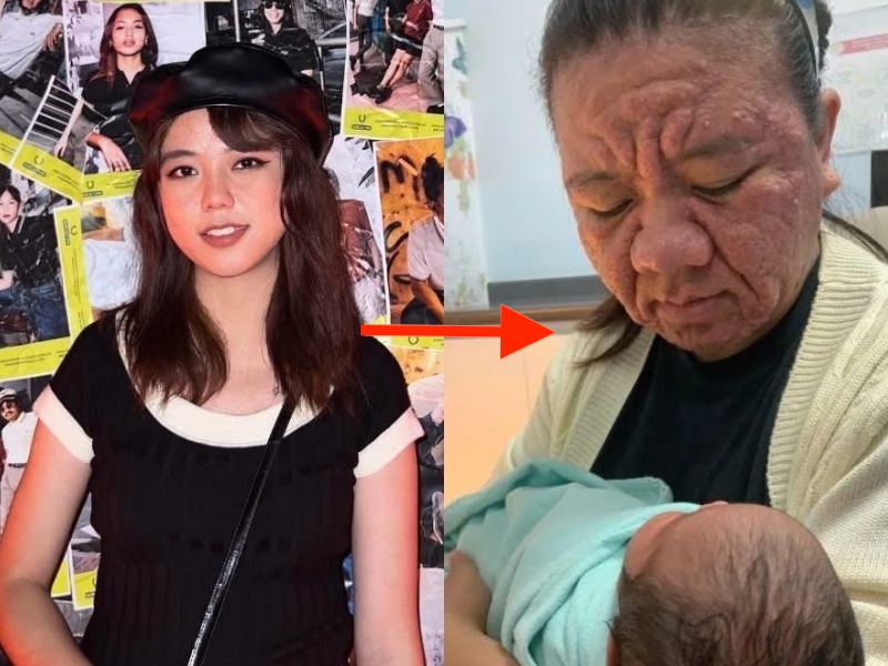 Mẹ bỉm 28 tuổi chia sẻ hình ảnh mang thai với gương mặt biến đổi hoàn toàn khiến cả cõi mạng dậy sóng- Ảnh 6.