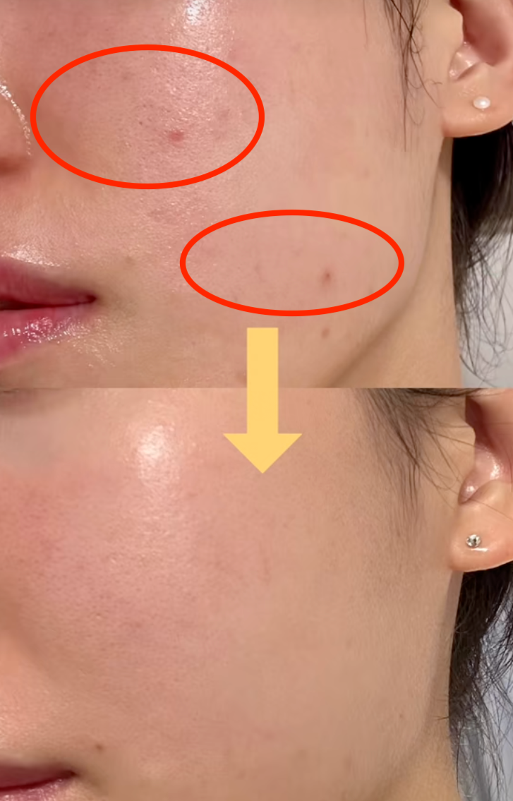 Chống già ở tuổi ngoài 35: Mỗi ngày uống một cốc nước màu cam được ví như "vitamin C trẻ hóa" làn da- Ảnh 10.