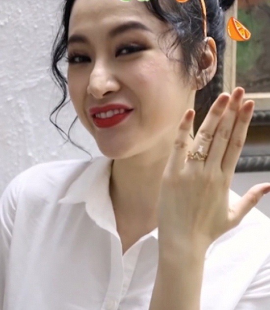 "Nữ hoàng thị phi Vbiz" bị biến dạng mũi, chưa đủ 18 tuổi đã "dao kéo"- Ảnh 7.
