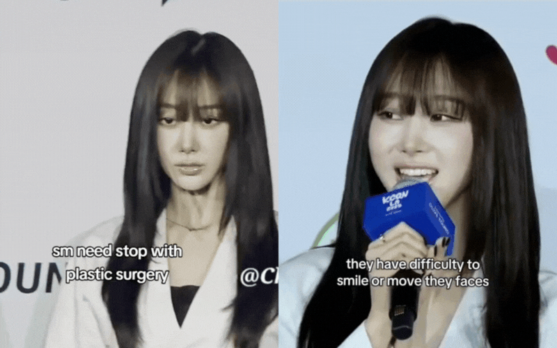 Gương mặt đơ cứng phát sợ của "biểu tượng slay" thế hệ mới: Giá phải trả cho "vịt hóa thiên nga" là đây?- Ảnh 5.