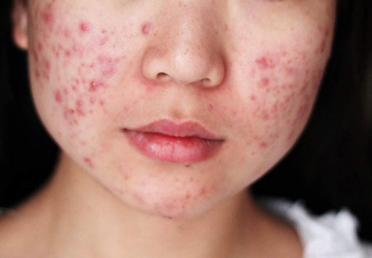 Tôi học Hòa Minzy uống 1 loại nước dân dã mong ngăn rối loạn nội tiết sau sinh, 1 tháng sau nhận ngay kết quả- Ảnh 1.