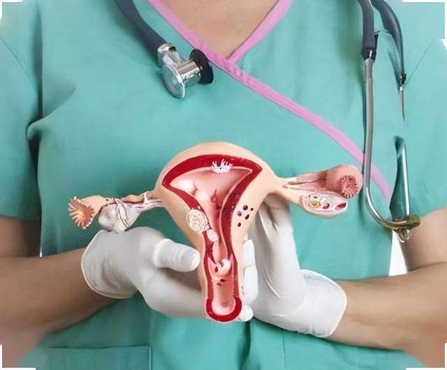 70% ung thư buồng trứng được chẩn đoán ở giai đoạn cuối: Phụ nữ sau tuổi 40 nếu gặp triệu chứng này cần khám ngay- Ảnh 4. 70% ung thư buồng trứng được chẩn đoán ở giai đoạn cuối: Phụ nữ sau tuổi 40 nếu gặp triệu chứng này cần khám ngay- Ảnh 4.