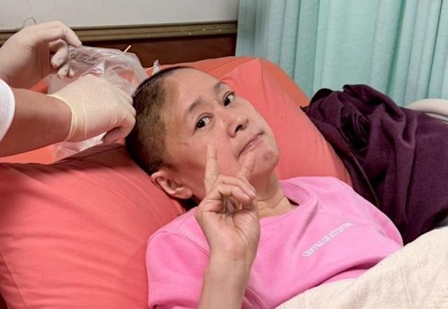 Nữ diễn viên truyền hình đình đám bàng hoàng vì bị mất 1 phần hộp sọ sau 5 ngày hôn mê- Ảnh 1.