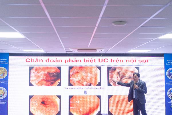 Viêm loét đại tràng trị hoài không khỏi, vì sao cần nội soi và sinh thiết chuẩn?- Ảnh 1.