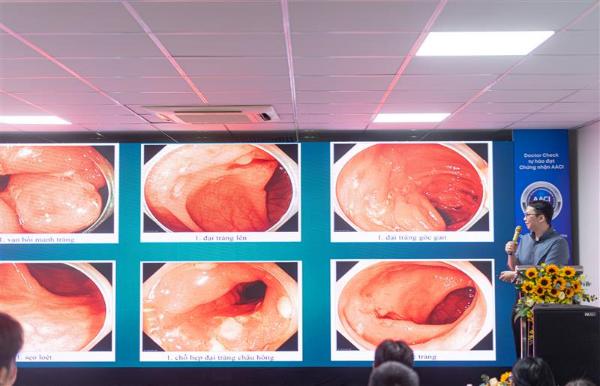 Viêm loét đại tràng trị hoài không khỏi, vì sao cần nội soi và sinh thiết chuẩn?- Ảnh 4.