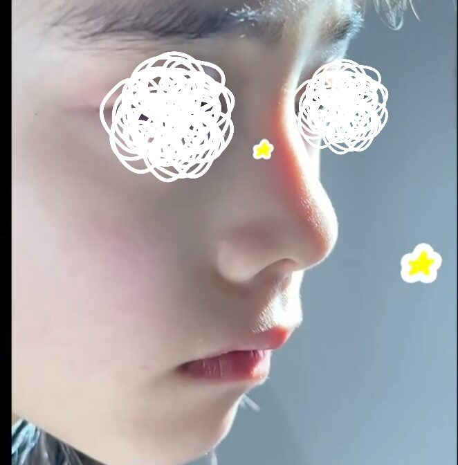 Mỹ nhân "mặt kim cương" làm mưa làm gió xứ Hàn lộ bằng chứng "dao kéo"?- Ảnh 2. Mỹ nhân "mặt kim cương" làm mưa làm gió xứ Hàn lộ bằng chứng "dao kéo"?- Ảnh 2.