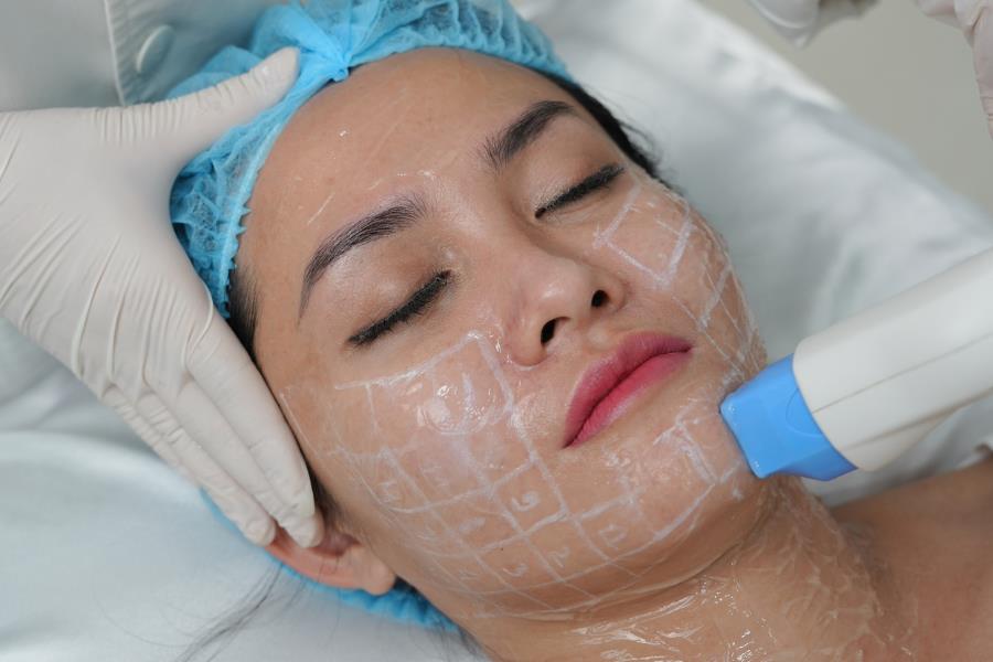 Top 7 công nghệ trẻ hóa da tiên tiến hiện nay- Ảnh 3.