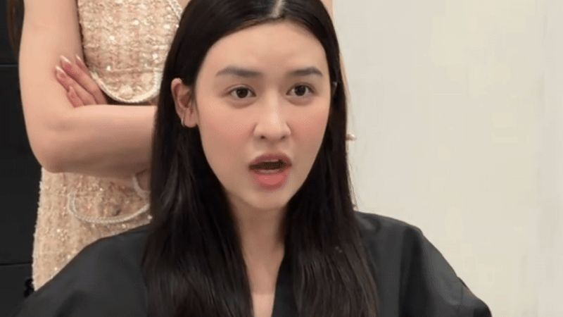 Quyên Qui tu sửa gương mặt - Ảnh 2.