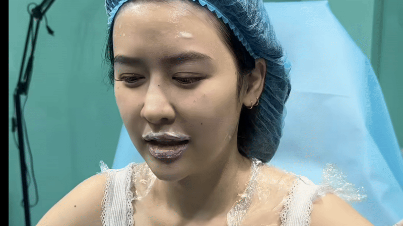 Quyên Qui tu sửa gương mặt - Ảnh 1.