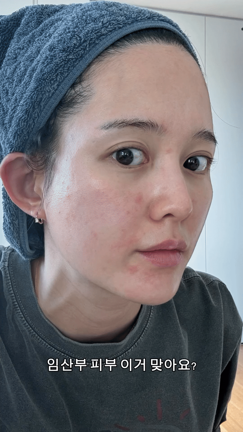 Xót xa mỹ nhân Mặt Trăng Ôm Mặt Trời bị hủy hoại nhan sắc khi mang thai- Ảnh 1. Xót xa mỹ nhân Mặt Trăng Ôm Mặt Trời bị hủy hoại nhan sắc khi mang thai- Ảnh 1.