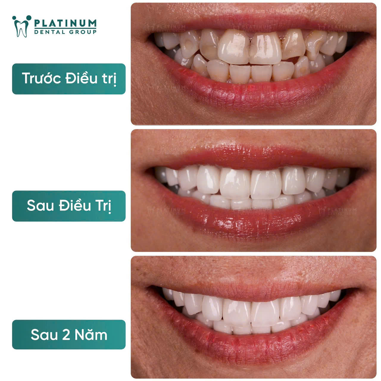 Không phải vì răng hỏng: Lý do khách hàng quay lại phòng khám nha khoa sau 5–7 năm - Ảnh 1.