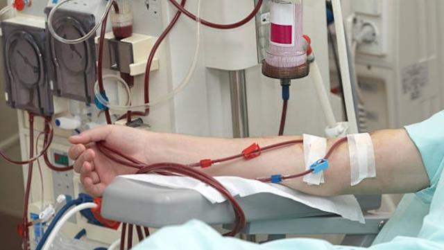 26 tuổi đã phải lọc máu cấp cứu: Bác sĩ cảnh báo 5 kiểu sống đang âm thầm hủy hoại thận của giới trẻ - Ảnh 2.