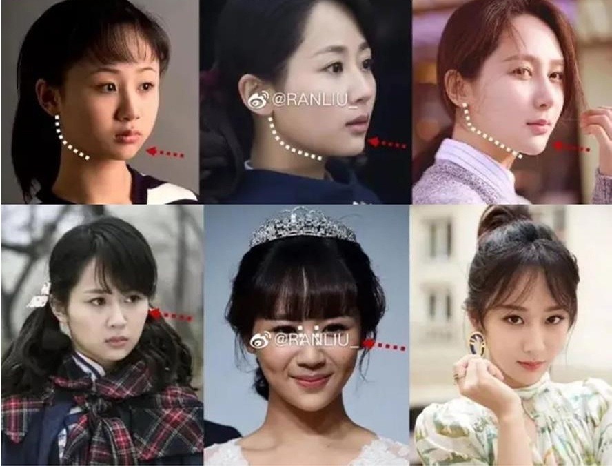 Bạn trai tin đồn kém 4 tuổi "đá" Lưu Diệc Phi để chạy theo "mỹ nhân 9X mặt búng ra silicon"?- Ảnh 8.