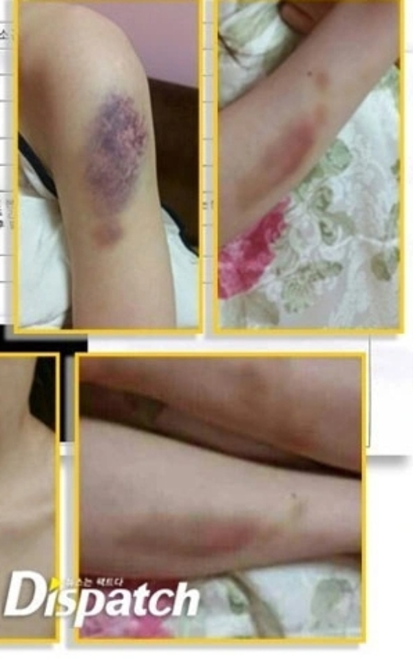 Bí mật động trời của Kim Hyun Joong (Vườn Sao Băng) sau 11 năm mới được công bố- Ảnh 2. Bí mật động trời của Kim Hyun Joong (Vườn Sao Băng) sau 11 năm mới được công bố- Ảnh 2.